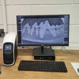 Dentalröntgen Röntgenbild